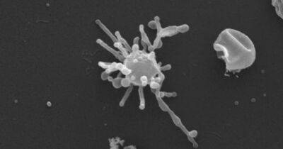 Микроб со щупальцами может быть прямым предком всей сложной жизни на Земле: что выяснили ученые - focus.ua - Австрия - Украина - Англия - Вена