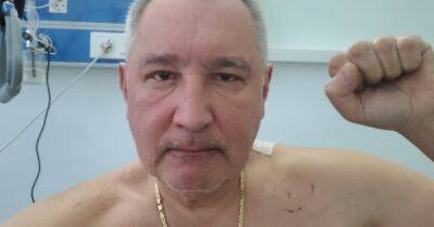 Рогозин, которого высмеяли за ранение "в зад", поделился фото из больницы