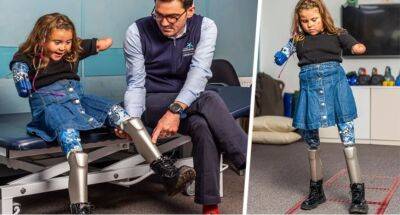 В Великобритании впервые установили восьмилетней девочке роботизированные ноги