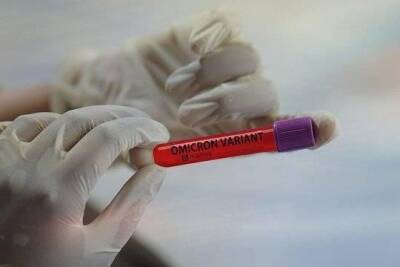 Врач предупредил о возможности сдачи отрицательных ПЦР-тестов при заражении омикрон-штаммом коронавируса