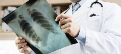 В Карелии 193 человека с пневмонией попали в больницы за неделю
