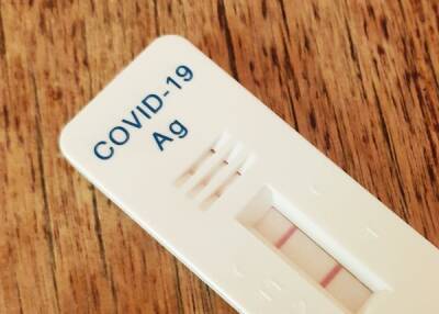 Минздрав разрешил утверждать диагноз "COVID-19" по экспресс-тестам