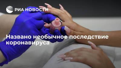 Иммунолог Крючков предупредил, что ногти после COVID-19 могут стать ломкими