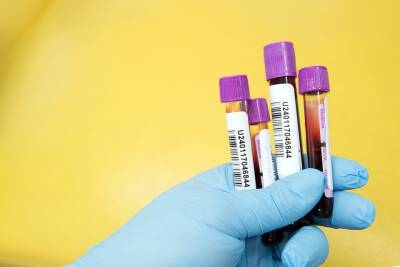 Поликлиника задержала результаты ПЦР-теста на коронавирус: куда жаловаться и как наказать медучреждение