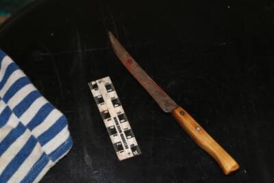 В Рязани мужчина ударил сожительницу ножом в шею