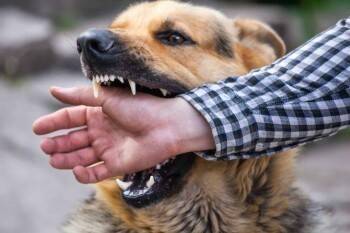 Кусь по 200 тысяч: за нападения собак заплатят чиновники