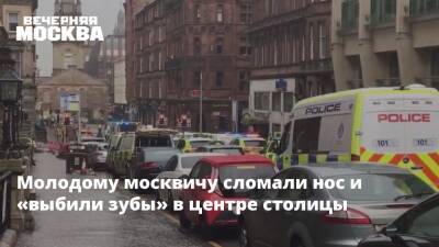 Молодому москвичу сломали нос и «выбили зубы» в центре столицы