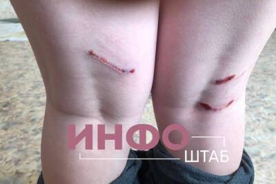 «Как ходить в школу, если они везде?»: в Астрахани собака вновь напала на ребенка