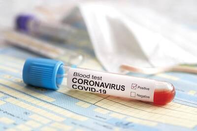 Зарегистрирован первый случай коронавируса среди участников выборов федерального президента