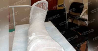 Избитая подростками в Екатеринбурге о нападении: Они сломали мне ногу