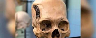 В Музее остеологии Оклахома-Сити хранится древний череп с металлическим имплантатом
