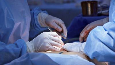 В органе для трансплантации впервые изменили группу крови