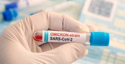 Частные лаборатории в Новосибирске начали делать тесты на наличие омикрон-штамма COVID-19