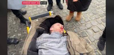 У центрі Києва сталася стрілянина. Поранено учасника АТО
