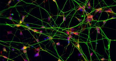 Ученые обнаружили способ восстановления нервных клеток