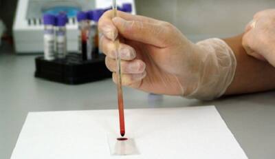 В России создадут антибиотик из человеческой крови