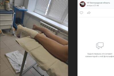 В Белгороде школьница сломала ногу во время поездки в забитом автобусе