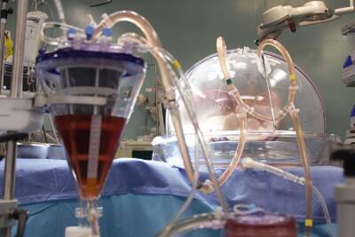 Ученые смогли изменить группу крови донорских легких — всего за 1 час