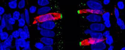 Учёные Университета Северной Каролины составили полную «карту» клеток кишечника человека