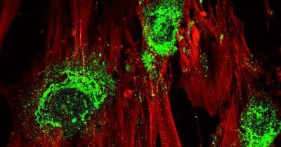 Новый путь к регенерации: ученые превратили стволовые клетки в кость с помощью звука