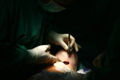 Пластический хирург обманул «мас ахнасу» на 35 млн шекелей
