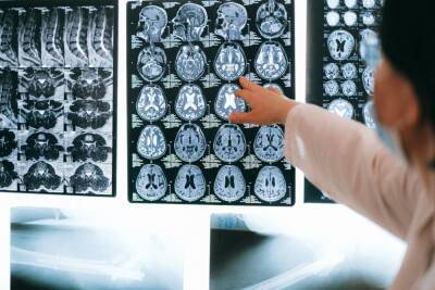 Исследователи впервые зафиксировали активность умирающего мозга