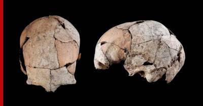 Даже рану прижгли: на 5300-летнем черепе заметили следы древнейшей хирургической операции