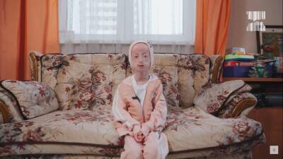 Девочка из Новосибирска с синдромом преждевременного старения поучаствовала в ток-шоу на Первом канале