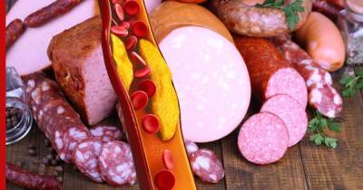 Высокий холестерин: какие продукты противопоказаны