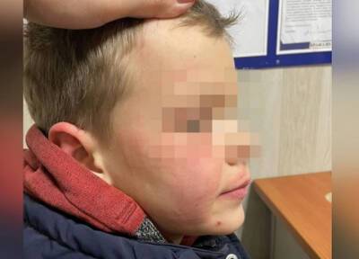 Мужчина в Екатеринбурге избил случайно попавшего в него снежком чужого ребенка