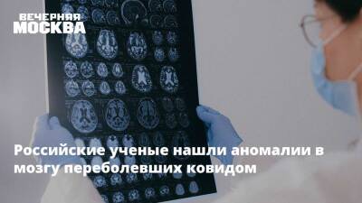 Российские ученые нашли аномалии в мозгу переболевших ковидом