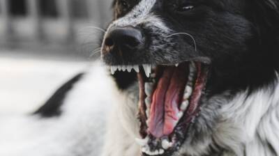 Воронежские следователи проверят информацию о нападении стаи собак на школьниц