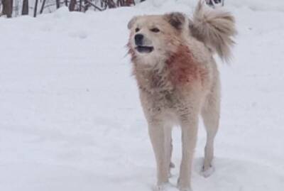 В Забайкальском крае собака «сняла скальп» с трехлетнего ребенка