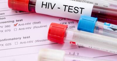 В Нидерландах обнаружен новый, более опасный вариант ВИЧ