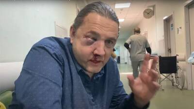 Избитый экс-депутат Шингаркин рассказал о поступавших ему угрозах