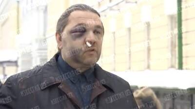 Экс-депутат Госдумы Шингаркин рассказал о нападении на него