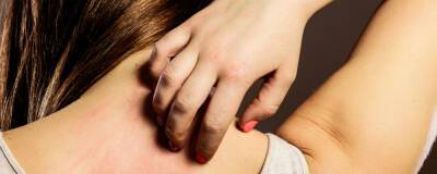 Врачи из ZOE COVID Study назвали шесть длительных кожных симптомов «омикрона»