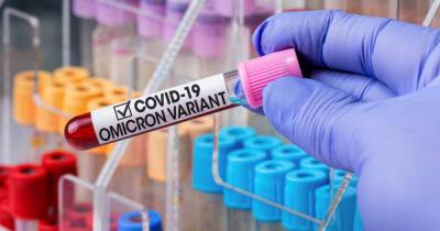 Вирусолог спрогнозировал будущее коронавируса после "омикрона"