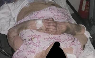 93-летнего ветерана выписали из больницы обезвоженной, полураздетой и с синяками по всему телу