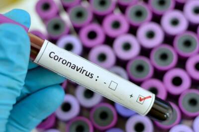 Число заразившихся COVID-19 в Ленобласти составило 2214 за сутки