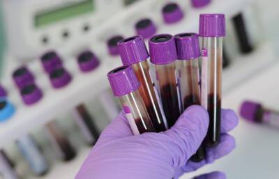 QR-коды по тестам на антитела начнут выдавать с 21 февраля