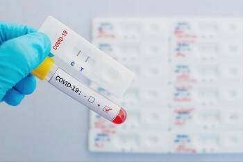 Минздрав: QR-код по результатам теста на антитела можно будет получить уже с …