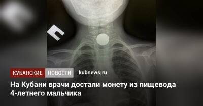 На Кубани врачи достали монету из пищевода 4-летнего мальчика - kubnews.ru - Краснодарский край - Туапсе