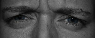 Ученые обнаружили связь между депрессией и тяжелым течением синдрома сухого глаза