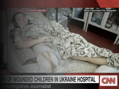 CNN показав 15-річну українку, якій внаслідок російських обстрілів ампутували ногу