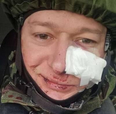 Лидер группы «Бумбокс» попал под минометный огонь и был ранен (ФОТО)