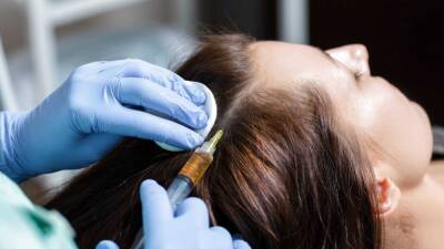 Мезотерапия для кожи головы ускорит рост волос и улучшит их состояние