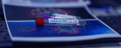 В России приступили к испытанию кожного теста на антитела к COVID-19