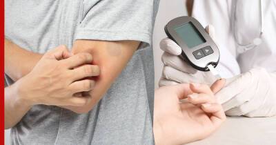 Симптомы диабета: 2 необычных кожных проявления укажут на высокий сахар