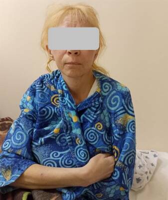 40-летняя женщина со шрамами нашла родственников в Ульяновской области